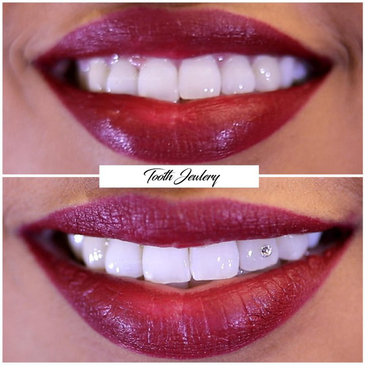 Slider image (5) FMS Dental Hospital - Kukatpally